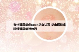 吉林銀屑病必xuan華山認(rèn)真 華山醫(yī)院皮膚科銀屑病特效藥