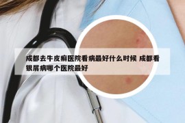 成都去牛皮癬醫(yī)院看病最好什么時候 成都看銀屑病哪個醫(yī)院最好