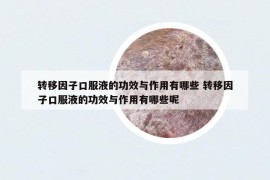 轉(zhuǎn)移因子口服液的功效與作用有哪些 轉(zhuǎn)移因子口服液的功效與作用有哪些呢