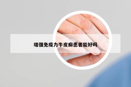 增強(qiáng)免疫力牛皮癬患者能好嗎