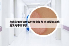 點滴型銀屑病什么時候會復發(fā) 點滴型銀屑病復發(fā)幾率高不高