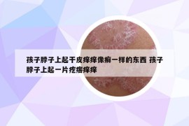 孩子脖子上起干皮癢癢像癬一樣的東西 孩子脖子上起一片疙瘩癢癢