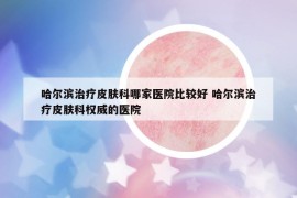 哈爾濱治療皮膚科哪家醫(yī)院比較好 哈爾濱治療皮膚科權(quán)威的醫(yī)院