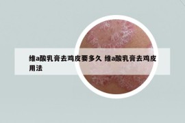 維a酸乳膏去雞皮要多久 維a酸乳膏去雞皮用法