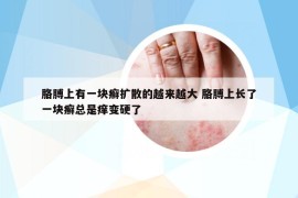 胳膊上有一塊癬擴散的越來越大 胳膊上長了一塊癬總是癢變硬了