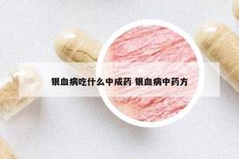 銀血病吃什么中成藥 銀血病中藥方