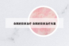 白斑的飲食治療 白斑的飲食治療方案