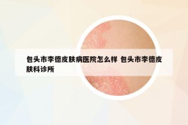 包頭市李德皮膚病醫(yī)院怎么樣 包頭市李德皮膚科診所