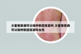 少量銀屑病可以接種新冠疫苗嗎 少量銀屑病可以接種新冠疫苗嗎女性