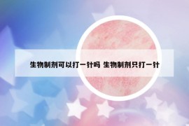 生物制劑可以打一針嗎 生物制劑只打一針