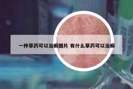 一種草藥可以治癬圖片 有什么草藥可以治癬