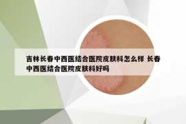 吉林長(zhǎng)春中西醫(yī)結(jié)合醫(yī)院皮膚科怎么樣 長(zhǎng)春中西醫(yī)結(jié)合醫(yī)院皮膚科好嗎