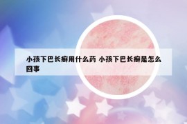 小孩下巴長癬用什么藥 小孩下巴長癬是怎么回事