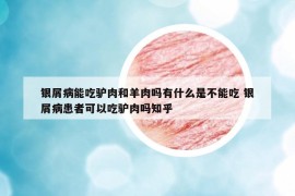 銀屑病能吃驢肉和羊肉嗎有什么是不能吃 銀屑病患者可以吃驢肉嗎知乎