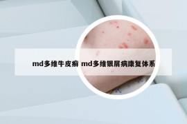 md多維牛皮癬 md多維銀屑病康復(fù)體系
