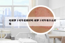 吃胡蘿卜對(duì)牛皮癬好嗎 胡蘿卜對(duì)牛有什么好處