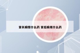 背長(zhǎng)癬擦什么藥 背后癬用什么藥