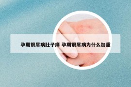 孕期銀屑病肚子癢 孕期銀屑病為什么加重