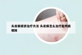 頭皮癬癥狀治療方法 頭皮癬怎么治療能徹底根除