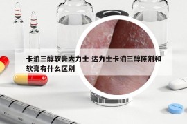 卡泊三醇軟膏大力士 達(dá)力士卡泊三醇搽劑和軟膏有什么區(qū)別