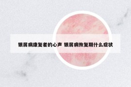 銀屑病康復(fù)者的心聲 銀屑病恢復(fù)期什么癥狀