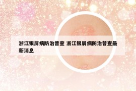 浙江銀屑病防治普查 浙江銀屑病防治普查最新消息