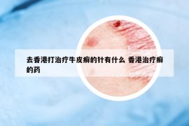 去香港打治療牛皮癬的針有什么 香港治療癬的藥