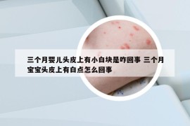 三個月嬰兒頭皮上有小白塊是咋回事 三個月寶寶頭皮上有白點怎么回事