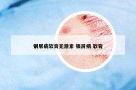 銀屑病軟膏無激素 銀屑病 軟膏