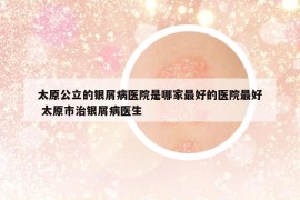 太原公立的銀屑病醫(yī)院是哪家最好的醫(yī)院最好 太原市治銀屑病醫(yī)生