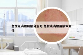 急性點滴銀屑病自愈吧 急性點滴銀屑病恢復(fù)慢
