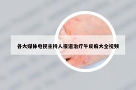 各大媒體電視主持人報(bào)道治療牛皮癬大全視頻