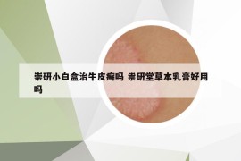 崇研小白盒治牛皮癬嗎 祟研堂草本乳膏好用嗎