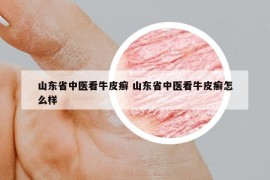 山東省中醫(yī)看牛皮癬 山東省中醫(yī)看牛皮癬怎么樣