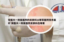 安醫(yī)大一附屬醫(yī)院的皮膚科口那家醫(yī)院技術(shù)最好 安醫(yī)大一附屬醫(yī)院皮膚科在哪里