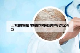 三生治銀屑病 銀屑病生物制劑哪種藥安全有效