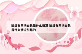 腦袋有兩塊白色是什么情況 腦袋有兩塊白色是什么情況引起的