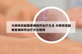 大斑塊狀副銀屑病如何治療方法 大斑塊狀副銀屑病如何治療方法視頻