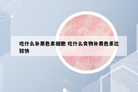 吃什么補黑色素細胞 吃什么食物補黑色素比較快