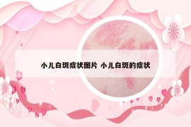 小兒白斑癥狀圖片 小兒白斑的癥狀