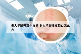 老人手腳開裂牛皮癬 老人手腳爆皮裂口怎么辦