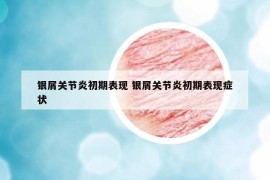銀屑關(guān)節(jié)炎初期表現(xiàn) 銀屑關(guān)節(jié)炎初期表現(xiàn)癥狀