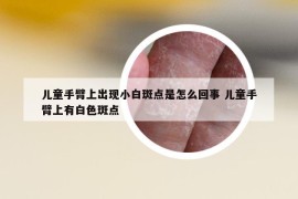 兒童手臂上出現(xiàn)小白斑點是怎么回事 兒童手臂上有白色斑點