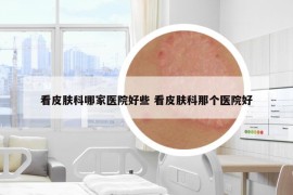 看皮膚科哪家醫(yī)院好些 看皮膚科那個醫(yī)院好