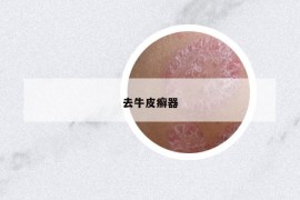 去牛皮癬器