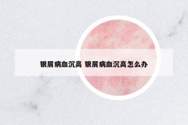 銀屑病血沉高 銀屑病血沉高怎么辦