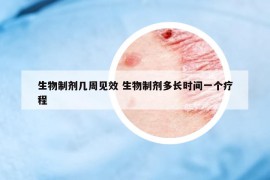 生物制劑幾周見效 生物制劑多長(zhǎng)時(shí)間一個(gè)療程