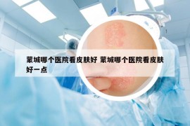 蒙城哪個醫(yī)院看皮膚好 蒙城哪個醫(yī)院看皮膚好一點