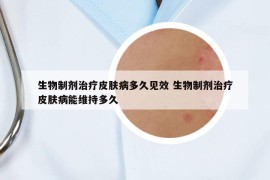 生物制劑治療皮膚病多久見效 生物制劑治療皮膚病能維持多久