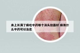 身上長(zhǎng)滿了癬吃中藥哪個(gè)湯頭放最好 癬用什么中藥可以治愈